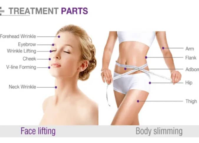 Diagram showing HIFU treatment areas for face lifting and body contouring, including forehead, cheeks, neck, arms, abdomen, and thighs