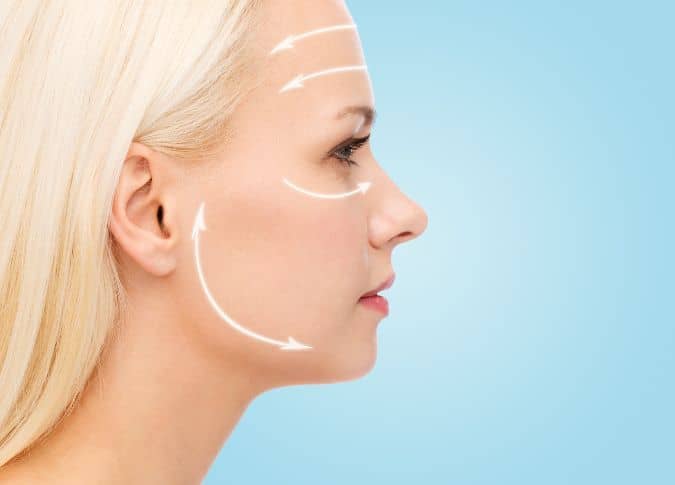 HIFU treatment areas on face for lifting and tightening